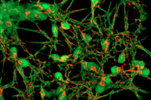 Alzheimers_NEURONS-IMAGE-2_605