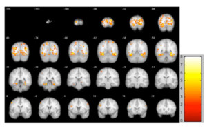brainscans500