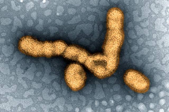 Swine Flu Outbreak in India Raises Concern 2 Colorized transmission electron micrograph showing H1N1 influenza virus particles. Source: National Institute of Allergy and Infectious Diseases/MIT