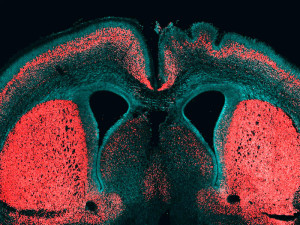 About 99 percent of human genes are shared with chimpanzees. Only the small remainder sets us apart. However, we have one important difference: The brain of humans is three times as big as the chimpanzee brain. During evolution our genome must have changed in order to trigger such brain growth. Wieland Huttner, Director and Research Group Leader a the Max Planck Institute of Molecular Cell Biology and Genetics (MPI-CBG), and his team identified for the first time a gene that is only present in humans and contributes to the reproduction of basal brain stem cells, triggering a folding of the neocortex. The researchers isolated different subpopulations of human brain stem cells and precisely identified, which genes are active in which cell type. In doing so, they noticed the gene ARHGAP11B: it is only found in humans and in our closest relatives, the Neanderthals and Denisova-Humans, but not in chimpanzees. This gene manages to trigger brain stem cells to form a bigger pool of stem cells. In that way, during brain development more neurons can arise and the cerebrum can expand. The cerebrum is responsible for cognitive functions like speaking and thinking.  Wieland Huttner’s researchers developed a method that isolates and identifies special subpopulations of brain stem cells from the developing human cerebrum. No one has managed to do this so far. The scientists first isolated different stem and progenitor cell types from fetal mice and human cerebrum tissue.  In contrast to the big and folded human brain, the brain of mice is small and smooth. After the isolation, the researchers compared the genes that are active in the various cell types and were able to identify 56 genes that are only present in humans and which play a role in brain development. “We noticed that the gene ARHGAP11B is especially active in basal brain stem cells. These cells are really important for the expansion of the neocortex during evolution,” says Marta Florio, PhD student in Wieland Huttner’s lab, who carried out the main part of the study.  The human-specific gene also works in mice  In the further course of the study, the researchers focused on the function of this special gene. The researchers suspected that if it was responsible for a bigger pool of brain stem cells in humans and thereby for an expanded cerebrum, then this human-specific gene should trigger a similar development in the smaller brain of a mouse. They introduced the gene into mice embryos and indeed: Under the influence of the human-specific gene, the mice produced significantly more brain stem cells and in half of all cases even a folding of the neocortex, which is typical for human brains.  All these results suggest that the gene ARHGAP11B plays a key role in the evolutionary expansion of the human neocortex.  Data from researchers working with Svante Pääbo from the Max Planck Institute for Evolutionary Anthropology in Leipzig confirm that ARHGAP11B not only occurs in the human genome, but also existed in the Neanderthals and Denisova-Humans. Neanderthals had a similar big brain to humans. “ARHGAP11B is the first human-specific gene where we could show that it contributes to the pool of basal brain stem cells and can trigger a folding of the neocortex. In that way, we managed to take the next step in tracing evolution”, summarizes Wieland Huttner