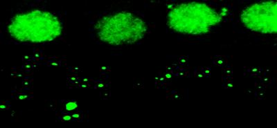 Noise-related Hearing Loss Might be in Your Genes 2 Immunostained mouse auditory nerve synapses after noise exposure. Source: Rick A. Friedman Lab/USC