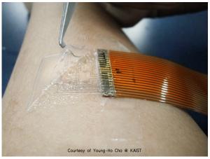 A goosebump sensor that reads your emotions 2 The goosebump detector is a skin piloerection monitoring sensor conformally attached to the forearm. Copyright : Courtesy of Young-Ho Cho @ KAIST