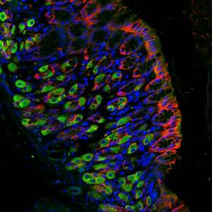 Immunofluorescence image of human stomach section stained for ARHGAP26 (green), epithelial cadherin (red) and cell nuclei (blue).Copyright : A*STAR