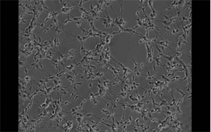 Bold new brain research in neuroengineering, brain-inspired design, and individuality 2 Much of how brain cells connect to create meaningful networks a mystery. One NSF-funded team seeks to develop a theory of how single neural cells form electrically active networks. The project will integrate emerging methods in computer science, systems biology, neuroengineering and developmental biology to offer insight into the brain's organization. This animation shows how young neurons develop over a two-day span. Credit: Arun Mahadevan, Qutub Lab, Department of Bioengineering, Rice University