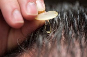 On Aug. 18, 2015, Josh Medow, medical director of the Neurocritical Intensive Care Unit at UW Hospital and Clinics, holds a small pressure-sensor implant, which he developed, that is capable of wirelessly measuring intracranial pressure in patients with brain injury or other head trauma. Medow is also associate professor of neurological surgery in the School of Medicine and Public Health (SMPH) at the University of Wisconsin-Madison. (Photo by Jeff Miller/UW-Madison)