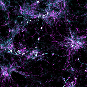 Patients’ Skin Cells helped scientists to create aged brain cells 2 Fibroblasts (cells in connective tissue) from elderly human donors are directly converted into induced neurons, shown. (Source: Salk Institute for Biological Studies)