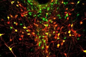 In this image of the dorsal raphe nucleus, dopamine neurons are labeled in green, red, or both (appearing yellow). (Image: Gillian Matthews)