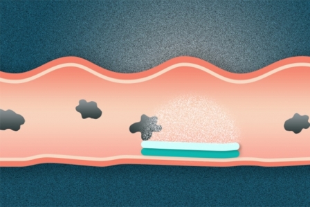 Researchers have created a new type of dual-sided pill that attaches to the gastrointestinal tract. One side of the pill sticks to mucosal surfaces, while the other is omniphobic, meaning that it repels everything it encounters. Illustration: Christine Daniloff/MIT