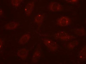This image shows protein aggregation in endothelial cells not exposed to PPIs. Credit: Houston Methodist