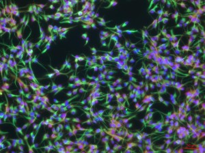 Neural stem cells were created from skin cells using a cocktail of only nine chemicals. This is the first time cellular reprogramming has been accomplished without adding external genes to the cells. (Source: Mingliang Zhang, Ph.D./Gladstone Institutes)