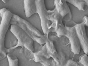 New Material Kills E. Coli Bacteria in 30 Seconds 2 A microscopic image of the E. coli bacteria after it has been destroyed by the antimicrobial material. © Institute of Bioengineering and Nanotechnology