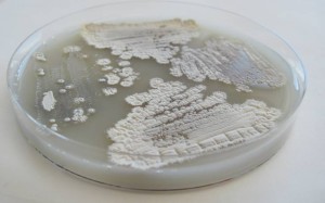 Counter to long-held belief about the bacteria Streptomyces, seen growing here in a petri dish, the ability to break down a stubborn molecule in plant cell walls called cellulose may be limited to just a few gifted strains. COURTESY OF ADAM BOOK/UW-MADISON 