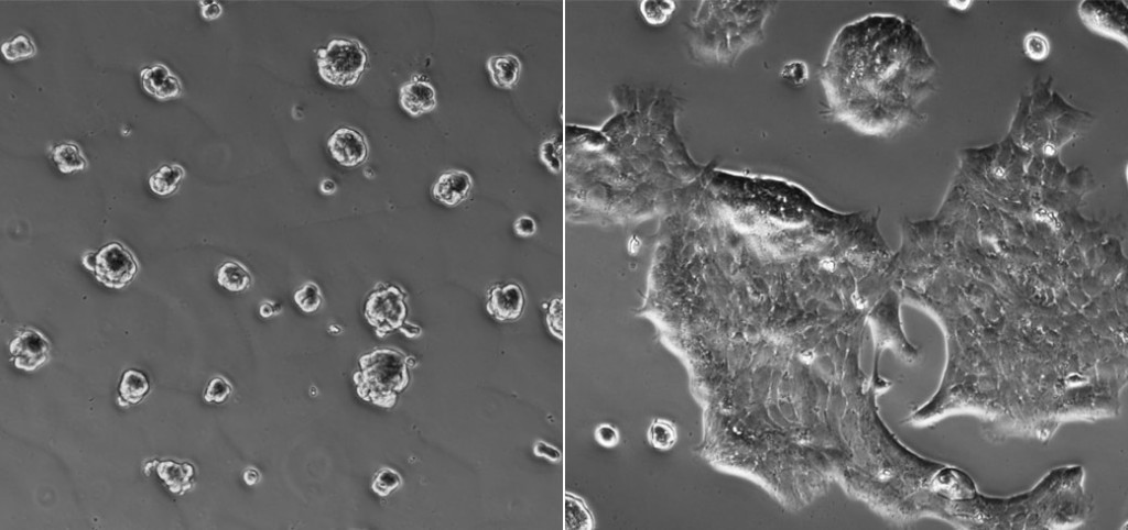 The illustration shows non-spreading cancer cells without these conditions (left), while those that are stiff and hypoxic (right) are beginning to spread. Image courtesy of Celeste Nelson, Department of Chemical and Biological Engineering.