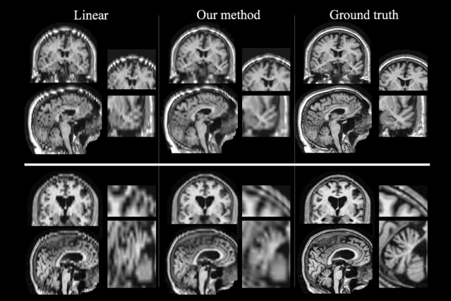 MIT Better MRI 0