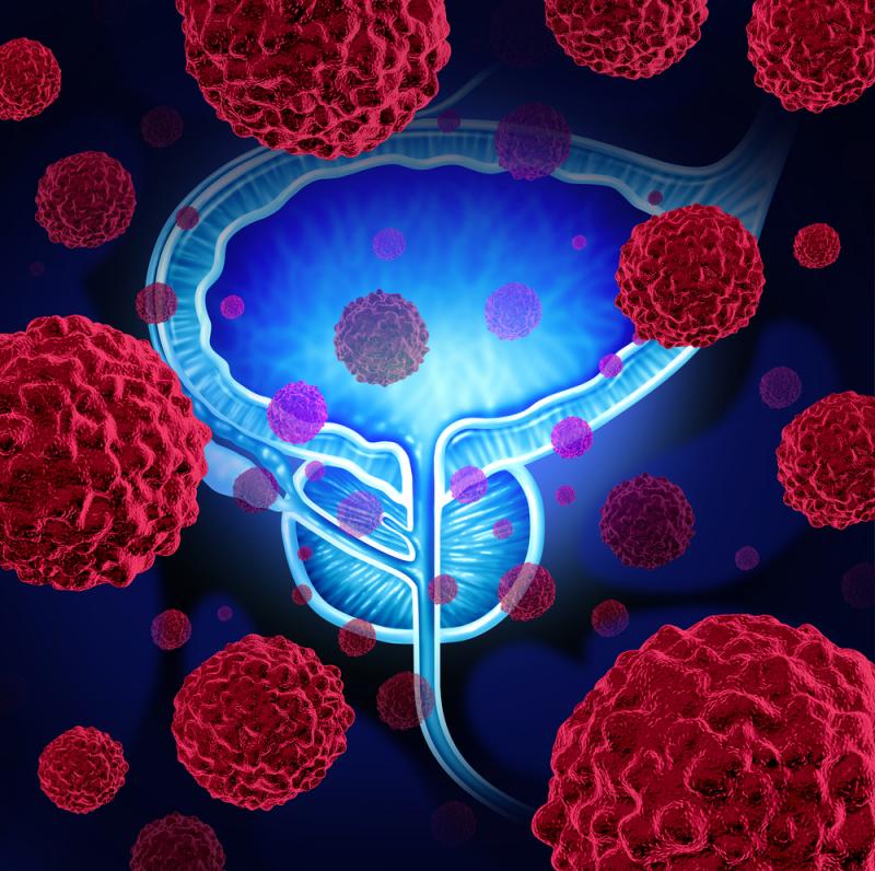 Scientists Uncover New Way to Defeat Therapy-Resistant Prostate Cancer