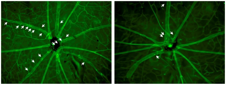 New RNAi treatment targets eye inflammation