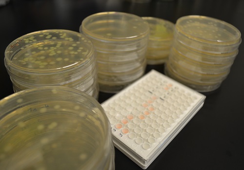 Researchers tracking superbug for antibiotic…