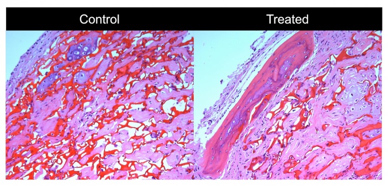 UW scientists find key cues to regulate bone-building cells