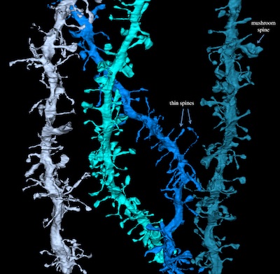 UW sleep research high-resolution images show how the brain resets during sleep