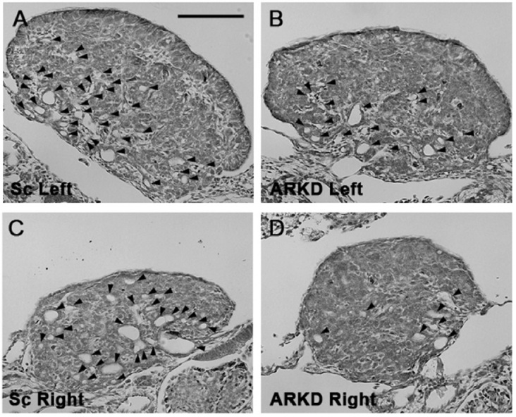 Male hormone plays key role in ovarian development