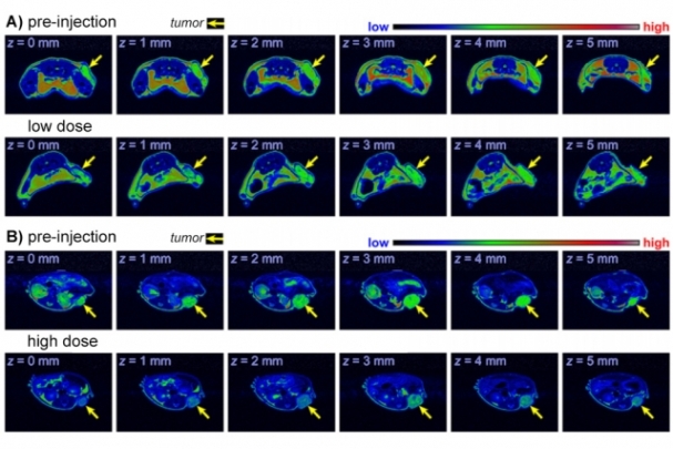 Metal-free MRI contrast agent could…