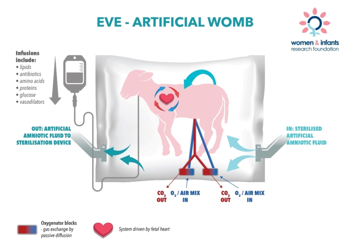 Artificial womb raises hope for…