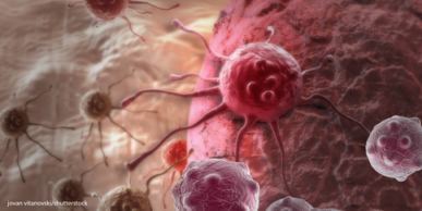 topslide cancer cell shutterstock