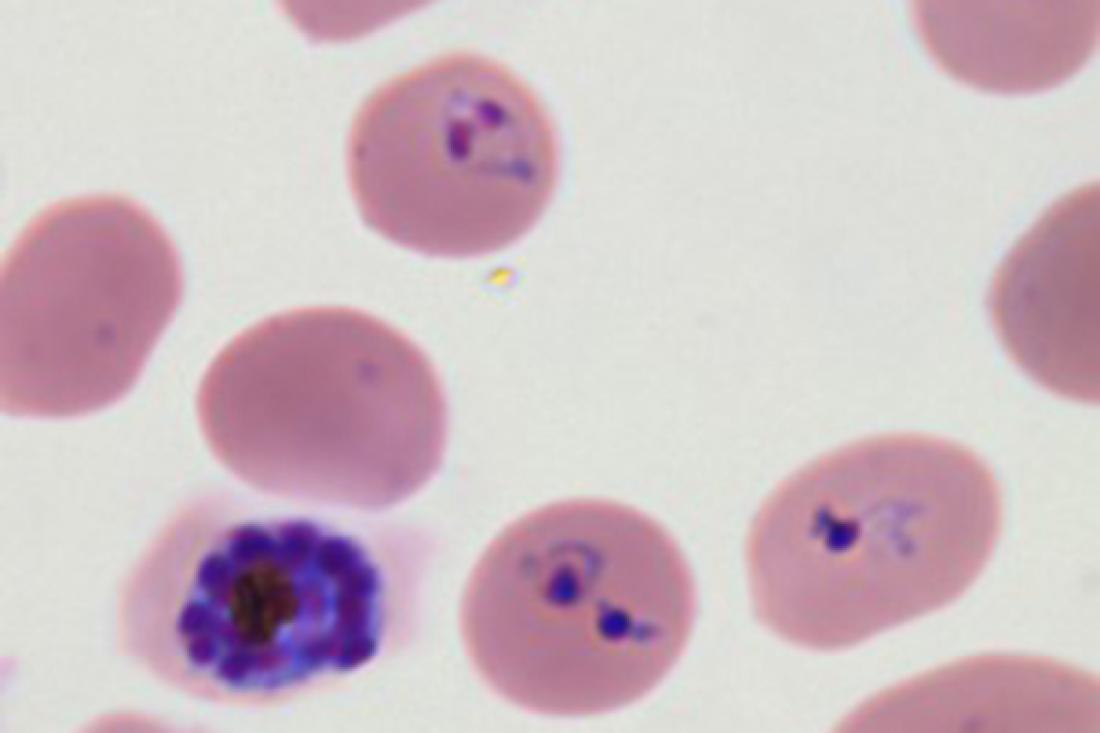 Researchers Map Malaria Parasites Proliferate…