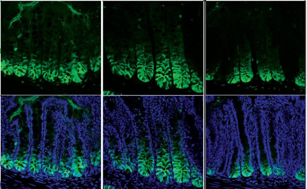 Protein links childhood stress to IBS 1 GD2