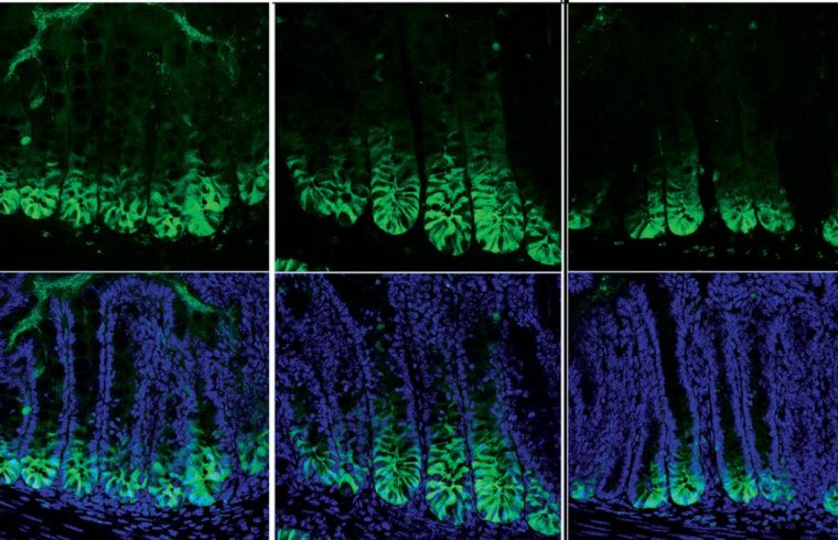 Protein links childhood stress to IBS 1 GD2