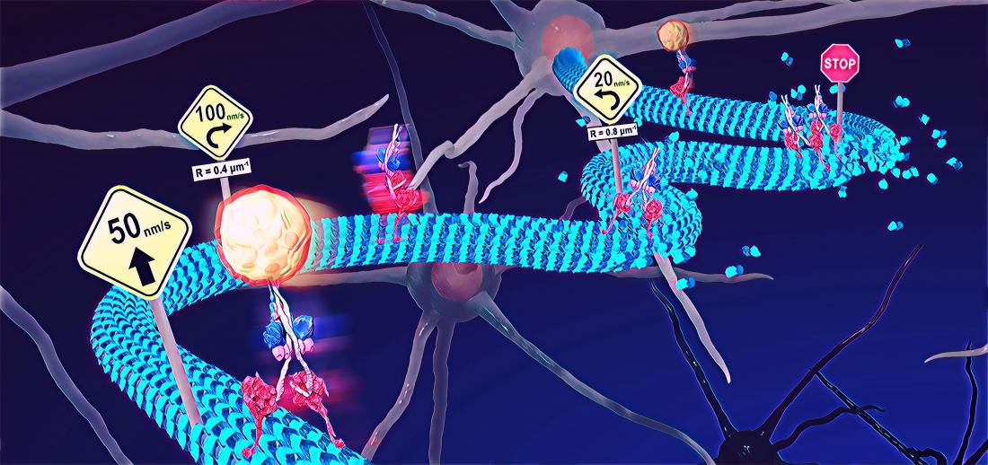 Cellular train track deformities shed light on neurological disease