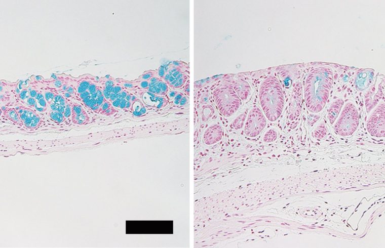 Fig1 Goblet cells in intestine