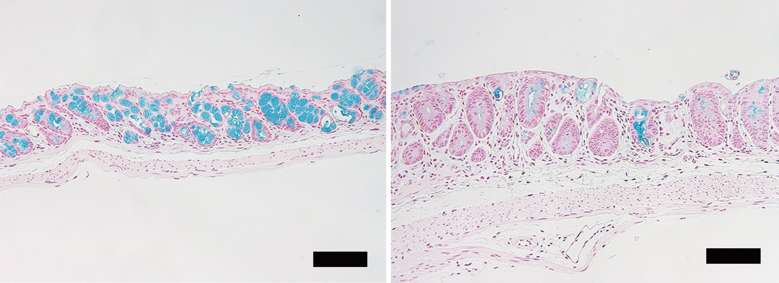 Loss of intestinal goblet cells…