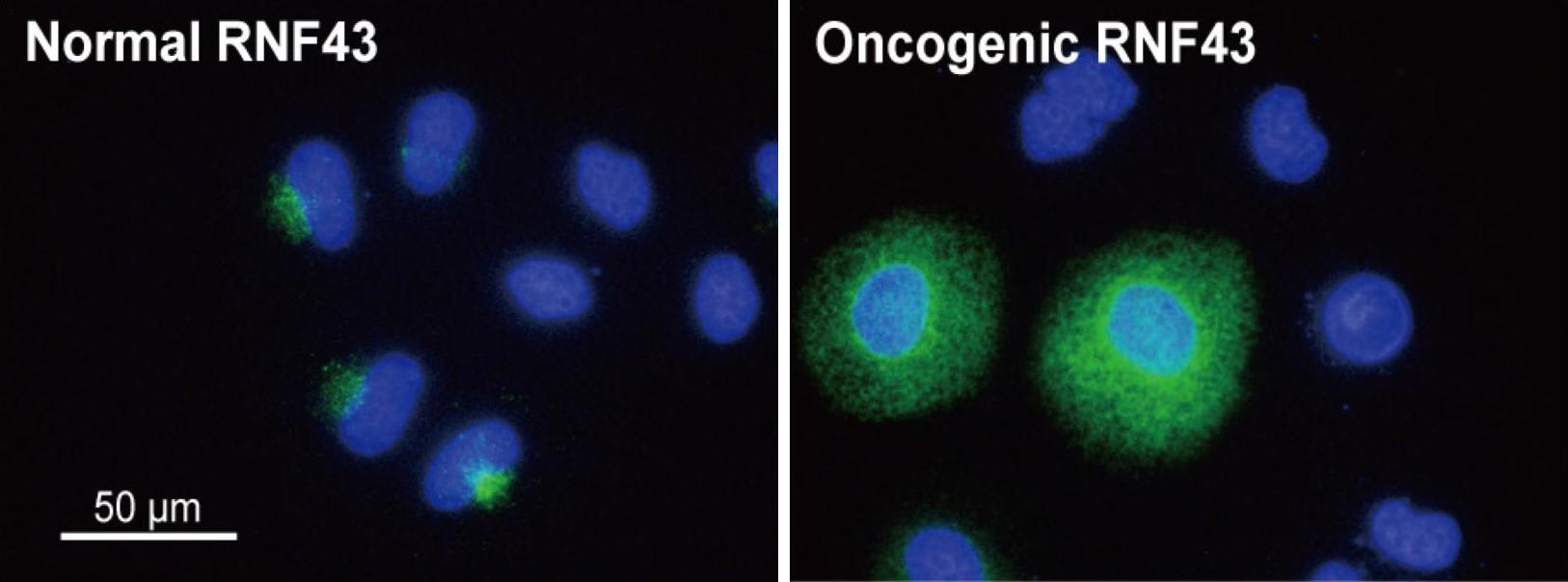 Scientists unraveled molecular mechanism behind colorectal cancer