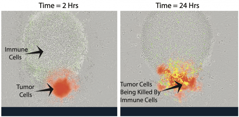 A new way to help the immune system fight back against cancer