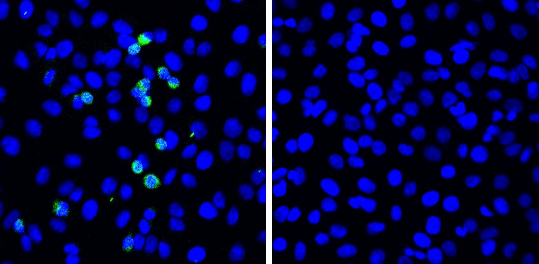 Novel defense mechanism for SARS-CoV-2 discovered