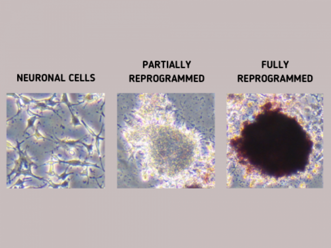 Raman spectroscopy track iPS cell reprogramming