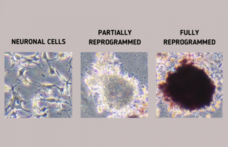 Raman spectroscopy track iPS cell reprogramming