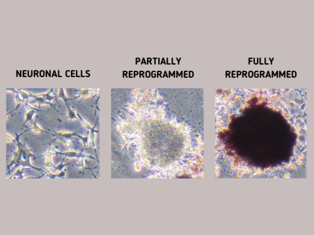 Scanning ‘chemical fingerprints’ to see if ordinary cell’s reprogramming into stem cell is glitch-free