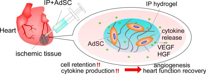 An injection made of a hydrogel containing stem cells could treat damaged tissue following a heart attack.