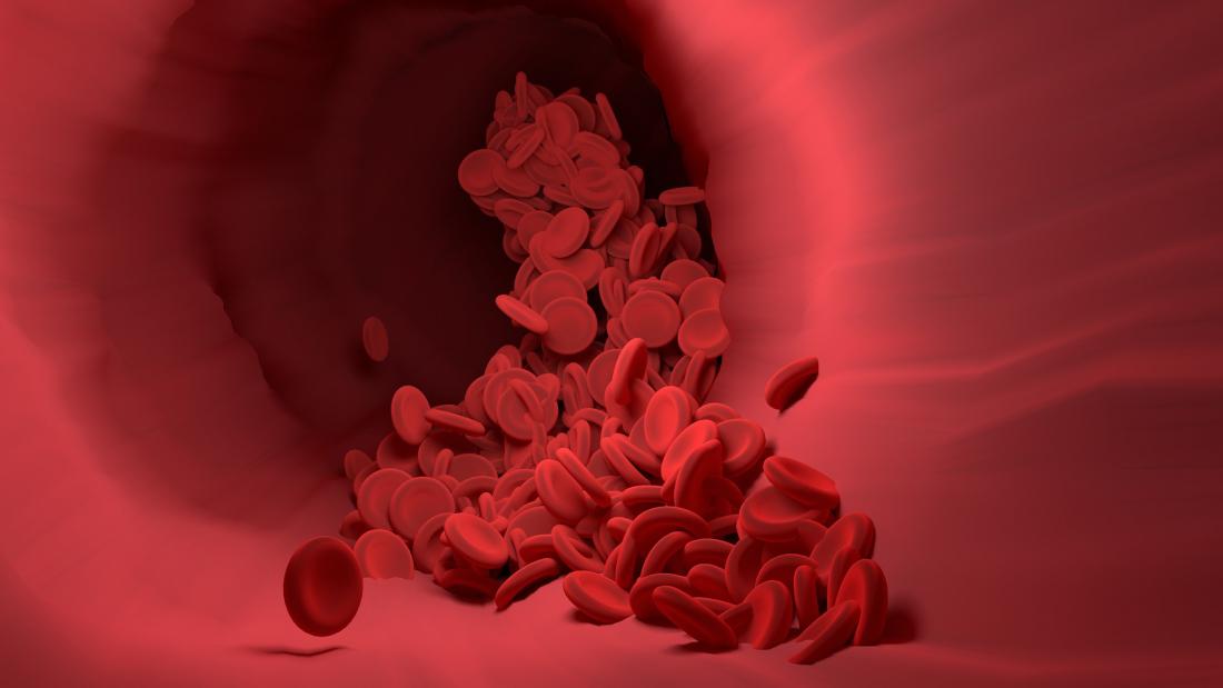 Complement protein Ba levels indicate transplant-associated thrombotic roangiopathymic