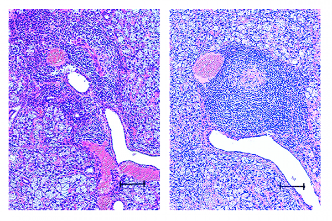 New Spontaneous Mouse Model Shows…