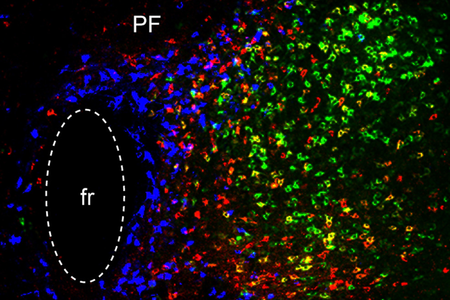 Three distinct brain circuits in…