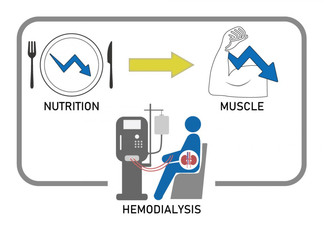 Malnutrition Links Kidney Disease, Weaker Muscles