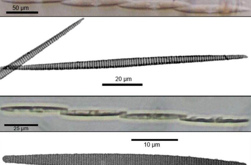 Two Pseudo-nitzschia diatom species identified in Luzon