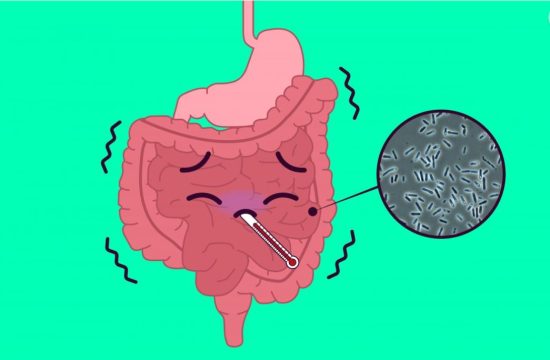 Clostridium perfringens