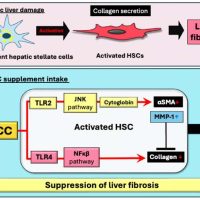 liver fibrosis