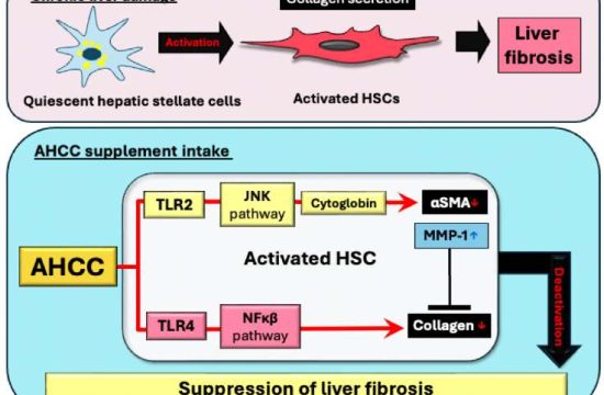 liver fibrosis