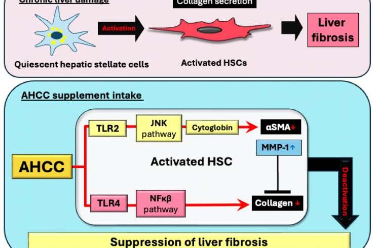 liver fibrosis